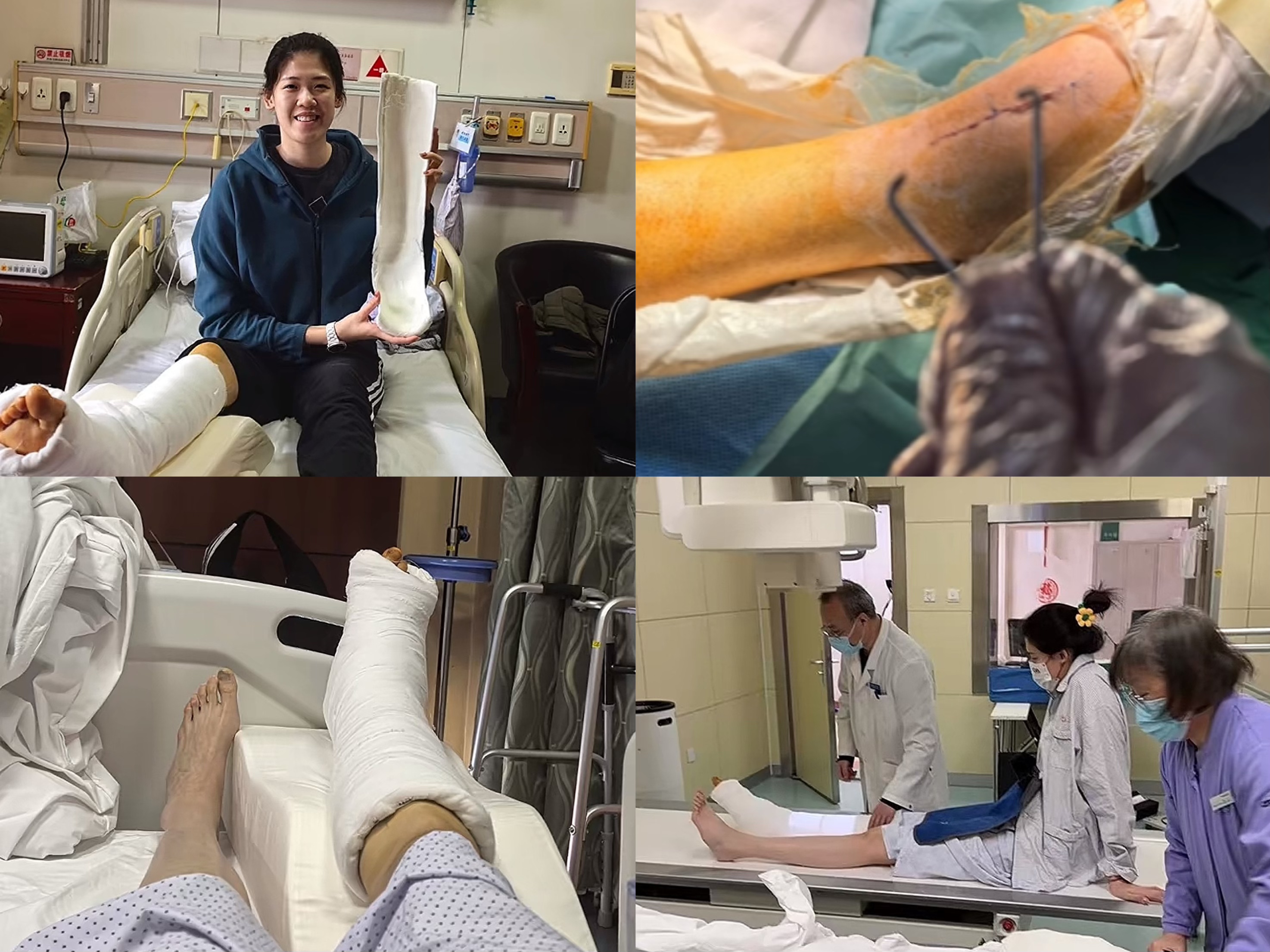 中国女排在, 力主攻复出